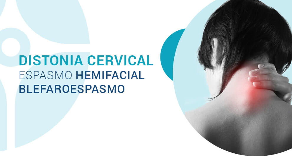 Distonia_Cervical - CINN  Neurologia e Neurocirugia Integradas